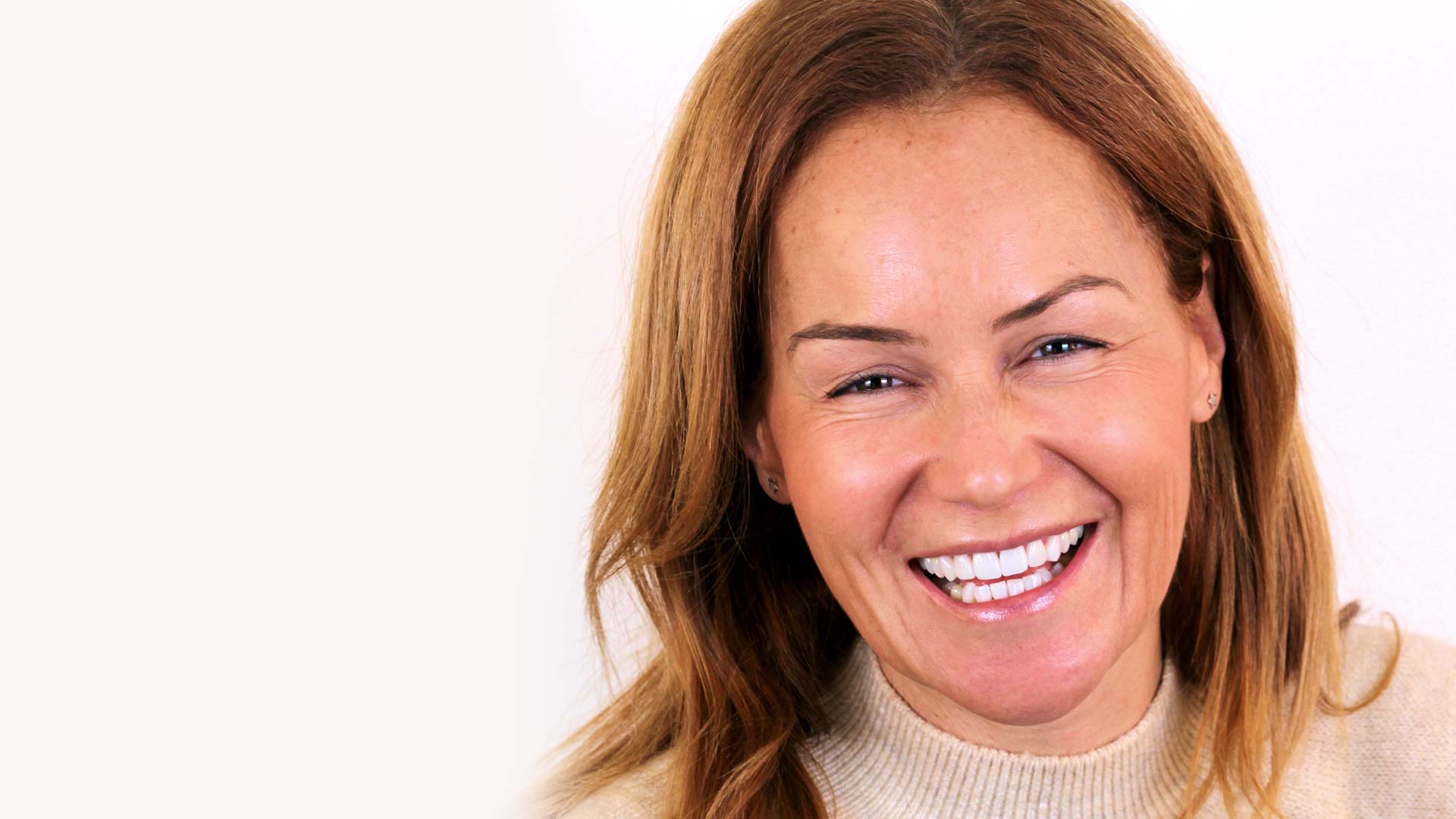 A woman smiles confidently after having Digital Smile Design dental treatment.